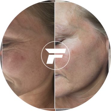 A woman 's face with the logo of a person