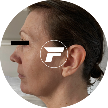 A woman with an ear tag and the logo for the firsbee.