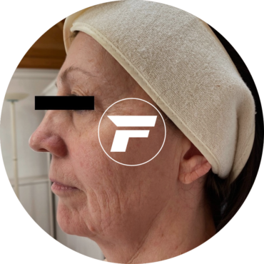 A woman with a towel on her head and face.